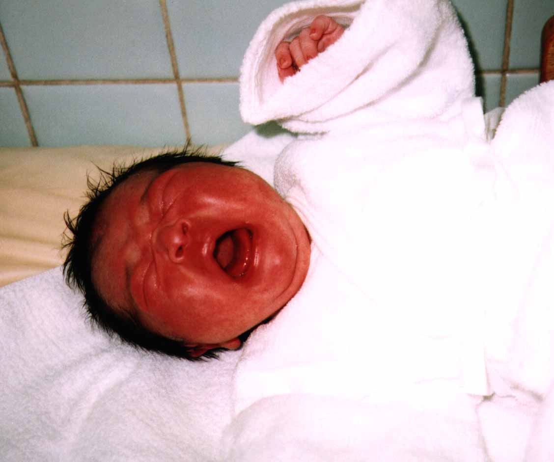 Joey01